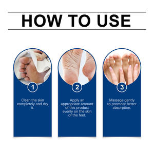 Talons fissurés exfoliant Anti fissure Peeling élimination de la peau morte réparation des pieds blanchissant crème pour les pieds à l'urée - Product Image 5