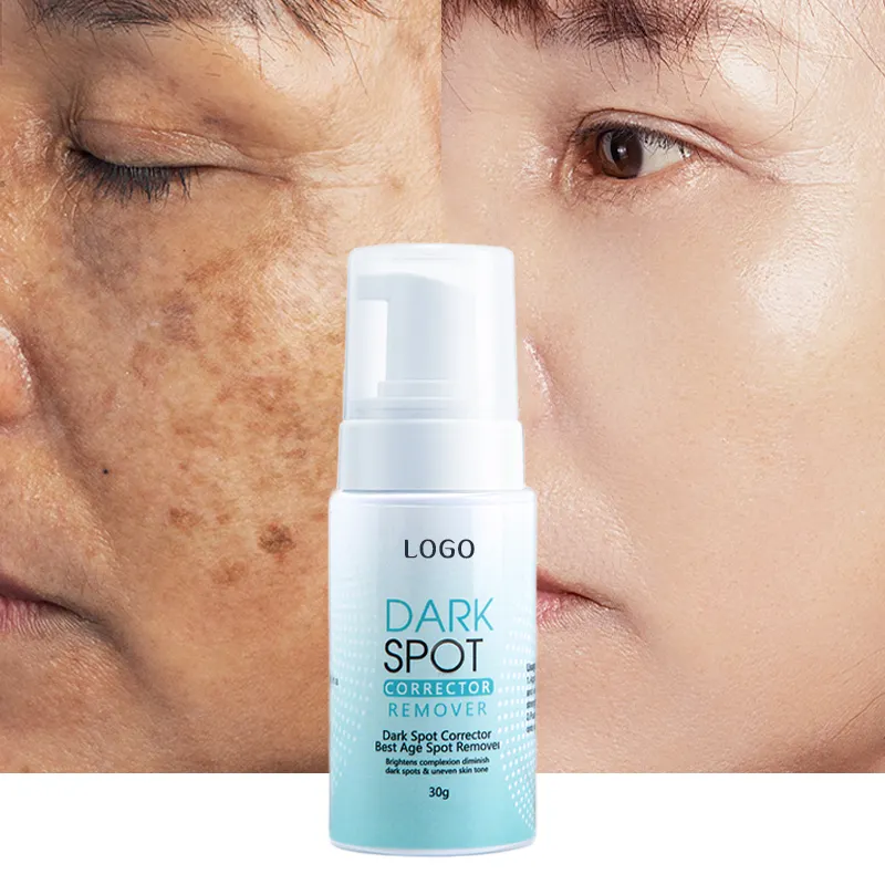 30g Organic Skin Whitening Anti Freckle Face Cream For Pigment Melasma Acne Pimples Dark Spot Removal
