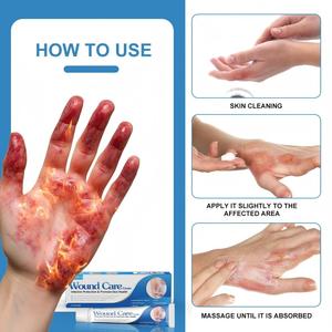 Baume de soin apaisant pour brûlures et plaies, à base de plantes, certifié ISO, crème réparatrice cutanée anti-infectieuse - Product Image 6