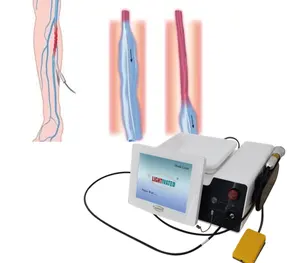 Máquina de cirurgia a laser de diodo 980nm1470nm, cânula de lipólise EVLT para varizes, canula para hemorróidas ginecológicas e pldd, laser retal
