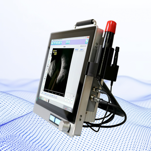 Novo modelo Eye <span class=keywords><strong>Test</strong></span> Scanner oftálmico AB Scan ultra-som A/B Scanner AB-S500 para diagnóstico de varredura ocular com A/B Probe - Product Image 2