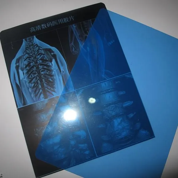 Impresión de inyección de tinta, película de imagen de rayos X láser seco médico para dispositivos mediales
