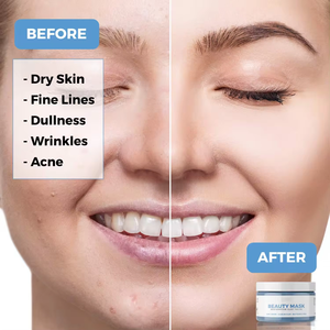 OEM Butterfly Face Clay Mask Deep Cleansing Kaolin for Oily Dry Skin Blackhead Remover Acne Moisturizer Glycerin Shea <strong>Zinc</strong> <strong>Oxide</strong> - Product Image 5