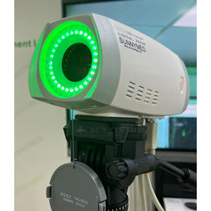 أفضل سعر لمنظار المهبل الطبي كامل HD بالفيديو لطب النساء منظار المهبل الرقمي لعيد الميلاد - Product Image 2