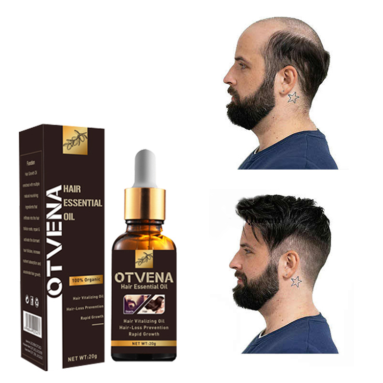 Top Selling Strong Healthy Hair Treatment Scalp OEM/ODM Regrowth Oil for Men Hair Growth Oil Serum