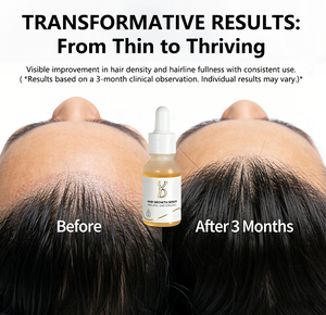 Suero Activador de Folículos Pilosos Naturalness para Micropigmentación del Cuero Cabelludo - Product Image 6