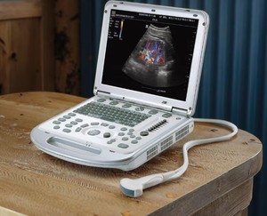 Sistema de Ultrasonido Diagnóstico Mindray M7 Aplicable <span class=keywords><strong>para</strong></span> Adultos, Mujeres Embarazadas, Pacientes Pediátricos y Neonatos - Product Image 6