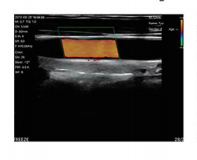 Doppler nirkabel 3 dalam 1 warna, instrumen ultrasound medis mini pendeteksi warna cembung genggam portabel Ultrasound <span class=keywords><strong>Linear</strong></span> - Product Image 3