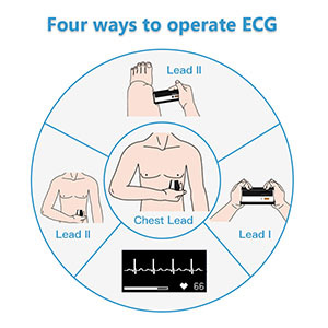 Monitor de Presión Arterial <span class=keywords><strong>Wellue</strong></span> <span class=keywords><strong>BP2</strong></span> Bluetooth para Brazo, Recargable, con ECG/EKG, Esfigmomanómetro - Product Image 5