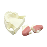 Modelo de Práctica para Extracción de Dientes Impactados, Modelo Oral Simulado con Diente Impactado Removible y Base Desmontable