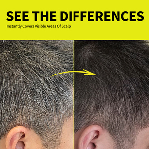 Sevich Xám tóc Bìa Stick lỏng 3 giây nhanh Xám Thuốc nhuộm tóc bút Keratin cái nhìn tự nhiên che khuyết điểm tóc Bìa - Product Image 4