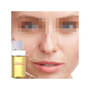 Suero Exfoliante Suave con Ácido Hipocloroso <span class=keywords><strong>y</strong></span> Extracto de Arroz para <span class=keywords><strong>C</strong></span>élulas Muertas de la Piel, Cuidado de Poros, Esencia para Puntos Negros, Cosméticos - Product Image 1