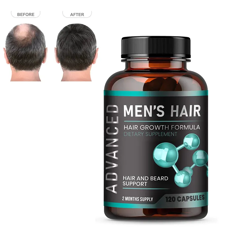 OEM Private Label Men's Hair Growth Supplement Clinically Proven Hair Capsules For Thicker And Stronger Hair Biotin Capsules