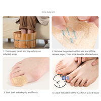 Patch réparateur d'onychomycose en hydrogel en forme d'éventail pour ongles souples, ongles incarnés, ongles épaissis