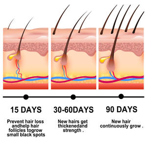 En stock formule de vente chaude efficace extrait de gingembre croissance des cheveux essentiel prévention de la perte de cheveux huile de croissance des cheveux - Product Image 2