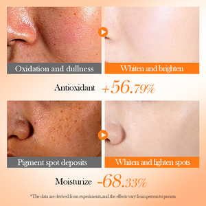 OEM <span class=keywords><strong>BIOAQUA</strong></span> facial VC blanqueamiento propiedades antioxidantes hierbas calmante cara hidratante nutritivo vitamina C cuidado de la piel conjunto - Product Image 5