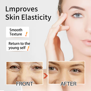 Nicotinamide Organic Whitening <strong>Cream</strong> Arbutin Night Bleaching <strong>Cream</strong> <strong>Lightening</strong> Face Whitening <strong>Cream</strong> <strong>for</strong> <strong>Dark</strong> <strong>Skin</strong> - Product Image 5