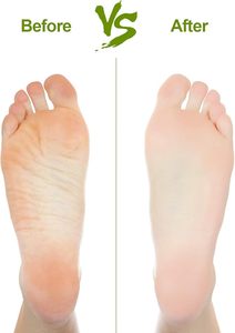 เครื่องมือทำเล็บเท้าแบบแข็งเครื่องกำจัดแคลลัสสำหรับเท้าและมือ - Product Image 4