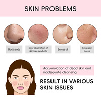 LAIKOU Nettoyant Visage Exfoliant Hydratant au Niacinamide et à la Fleur de Cerisier pour le Contrôle de l'Acné et l'Élimination des Points Noirs