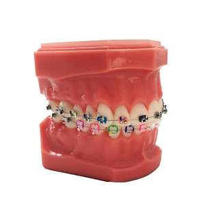 Diş sarf malzemeleri ortodontik pasif 2G kendinden bağlayıcı parantez - Product Image 3