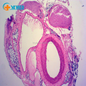 Lab und medizinische pathologie histologie objektträger, Medium-größe arterie und vene sec. - Product Image 2