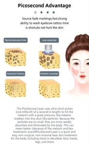 Machine d'épilation au laser à diode sans taxes, machine de beauté au laser Picolaser pour l'élimination des tatouages, laser ND YAG - Product Image 4