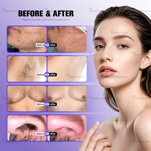 Analyseur de peau AI Prix <span class=keywords><strong>laser</strong></span> à diode à 4 longueurs d'onde Machine d'épilation <span class=keywords><strong>laser</strong></span> à diode permanente indolore 755nm 808nm 940nm 1064nm - Product Image 6