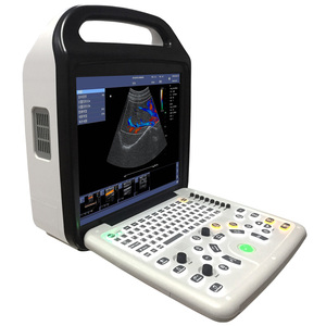 Échographe Doppler Couleur Portable Vétérinaire SONOIMAGE P50 <span class=keywords><strong>de</strong></span> Haute Qualité, Conception Légère, pour <span class=keywords><strong>la</strong></span> Gestation du Bétail - Product Image 5