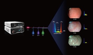 550S Sub gi thú y nội soi gastroenteroscope và enteroscope - Product Image 4