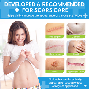 ELBBUB Private Label 1.5m Reparação Cicatrizes Cirúrgicas Keloid À Prova D' Água Folha De Cicatriz Reutilizável Remendos De Fita De Remoção De Cicatriz - Product Image 2