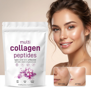 Hydrolyzed Multi <strong>Collagen</strong> Peptides | GMO-Free Unflavored Protein <strong>Powder</strong> | in Stock Ready to Ship | Wholesale Private Label - Product Image 1