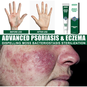 Crème hydratante et apaisante pour le <span class=keywords><strong>psoriasis</strong></span> et l'eczéma South Moon 20g, réduisant les démangeaisons - Product Image 6