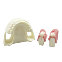 Modelo de Práctica para Extracción de Dientes Impactados, Modelo Oral Simulado con Diente Impactado Removible y Base Desmontable