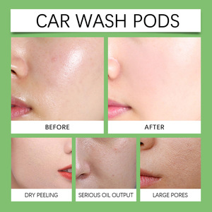 2025 Instant Post-Sun Repair Hidratación profunda Hidratación de larga duración Gel de aloe vera no graso - Product Image 5