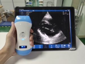 Escáner de Ultrasonido Doppler a Color 3 en 1 Inalámbrico, de Bajo Costo y Tamaño Compacto, Equipo Médico para Hospital - Product Image 2