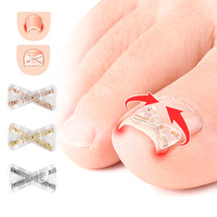 Correcteur d'ongles incarnés invisible en forme de X, léger, en alliage de nickel, auto-adhésif, pour l'hiver, vente en gros