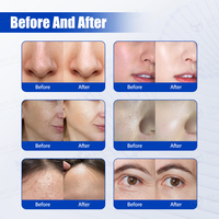 Mesin Facial Seaheart HydraMaster Patent Aqua Super Bubble Clean Skin Deep Moisturizing Face Lift Firm Whiten Hydro Oxygen