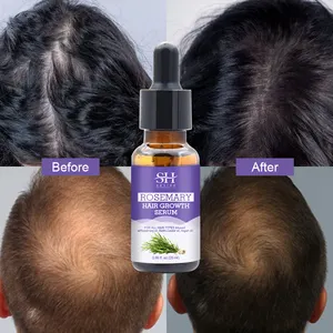 20Ml Anti Verlies Rozemarijn Ricinusolie Biotine Collageen Revitaliseert Haarzakjes Haargroei Olie Serum