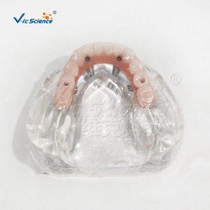 Modelo de restauración de implantes mandibulares de alta precisión M6001-1; Demostración de restauración Ma Longqiao; Entrenamiento para la escuela de medicina. - Product Image 2