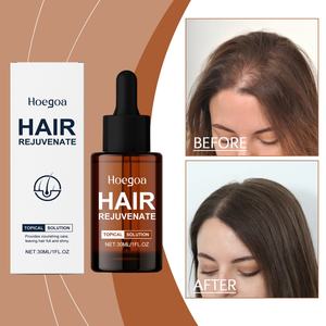 Loción para el Crecimiento del Cabello, Fórmula 2 en 1 con Botánicos Naturales para un Cabello Más Grueso y Fuerte, Tratamiento para el Cuero Cabelludo con Escualano - Product Image 2