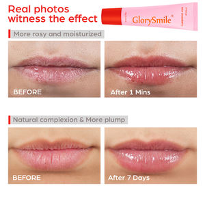 شعار خاص 10 جرام كريم العناية بالشفاه مرطب شفاه ليلي مع حاوية وردية ونكهة الفواكه قناع نوم صغير محمول للشفاه - Product Image 4