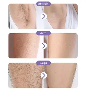 Épilateur en cristal pour l'épilation, indolore, sûr, réutilisable, facile à nettoyer, outil de dépilation physique en verre, gomme de beauté pour le corps - Product Image 4