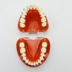 患者のデモンストレーションと説明のための4つのタイプのブラケット歯列矯正モデル - Product Image 4