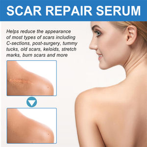 Jaysuing-<span class=keywords><strong>Gel</strong></span> cicatriciel avancé en <span class=keywords><strong>silicone</strong></span> pour cicatrices post-chirurgie - Product Image 6