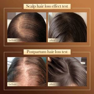 Productos para el Cuidado del Cabello al por Mayor, Champú Natural Anticaída con Queratina y Hoja de Ciprés Orgánica para Hombres y Mujeres - Product Image 6