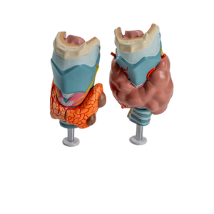 Modelo Patológico de Tiroides Humano, Hipertriatodermia, Hipotiatodermia, Sistema Endocrino, Herramienta de Enseñanza de Anatomía Médica - Product Image 1