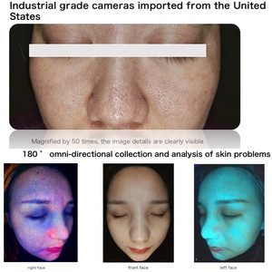 NewFace 2025 Pro, Analizador Facial Portátil para Esteticistas, Exclusivo para Uso Doméstico, Función de Análisis Facial, Máquina Facial Profesional - Product Image 4