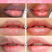 Sérum Lèvres Rose pour Pigmentation Foncée – Traitement Éclaircissant Rapide, Exfoliant et Repulpant – Formule Botanique Format Voyage à l'Aloe Vera et au Beurre de Karité