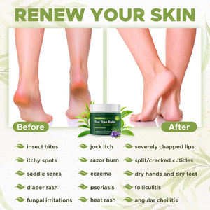 Naturals Vitamine E Baume à l'huile <span class=keywords><strong>d</strong></span>'arbre à thé pour <span class=keywords><strong>d</strong></span>émangeaisons peau sèche squameuse et fissurée <span class=keywords><strong>pied</strong></span> <span class=keywords><strong>d</strong></span>'<span class=keywords><strong>athlète</strong></span> - Product Image 3