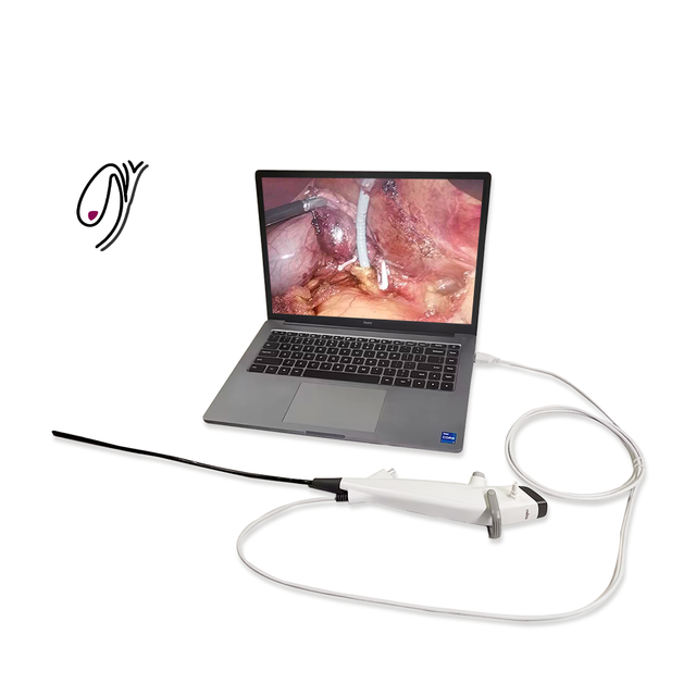 Endoso Video Coledocoscopio Medico Desechable Colecistoscopio Flexible Para Urologia
